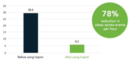 Inspire Chart