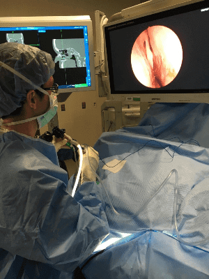 Performing Functional Endoscopic Sinus Surgery